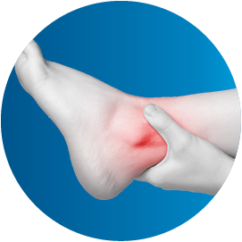 Joint_sprain_ICON_130x130px_EN100_1652949119_original.png